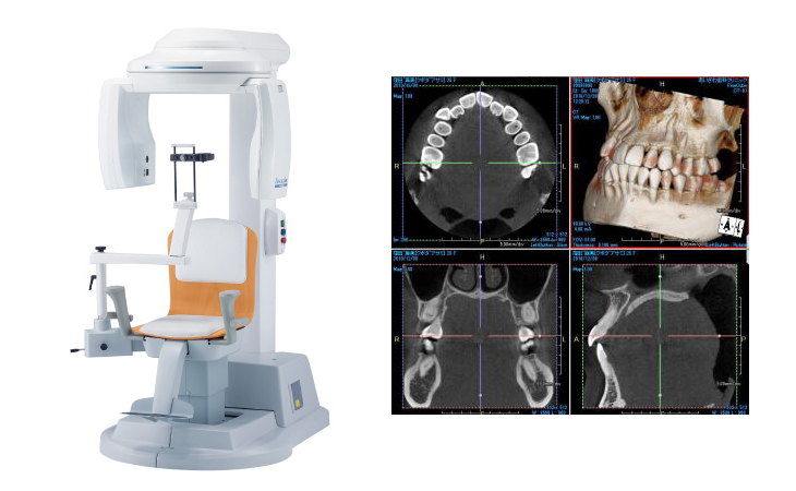 確実な診査・診断のための歯科用CT